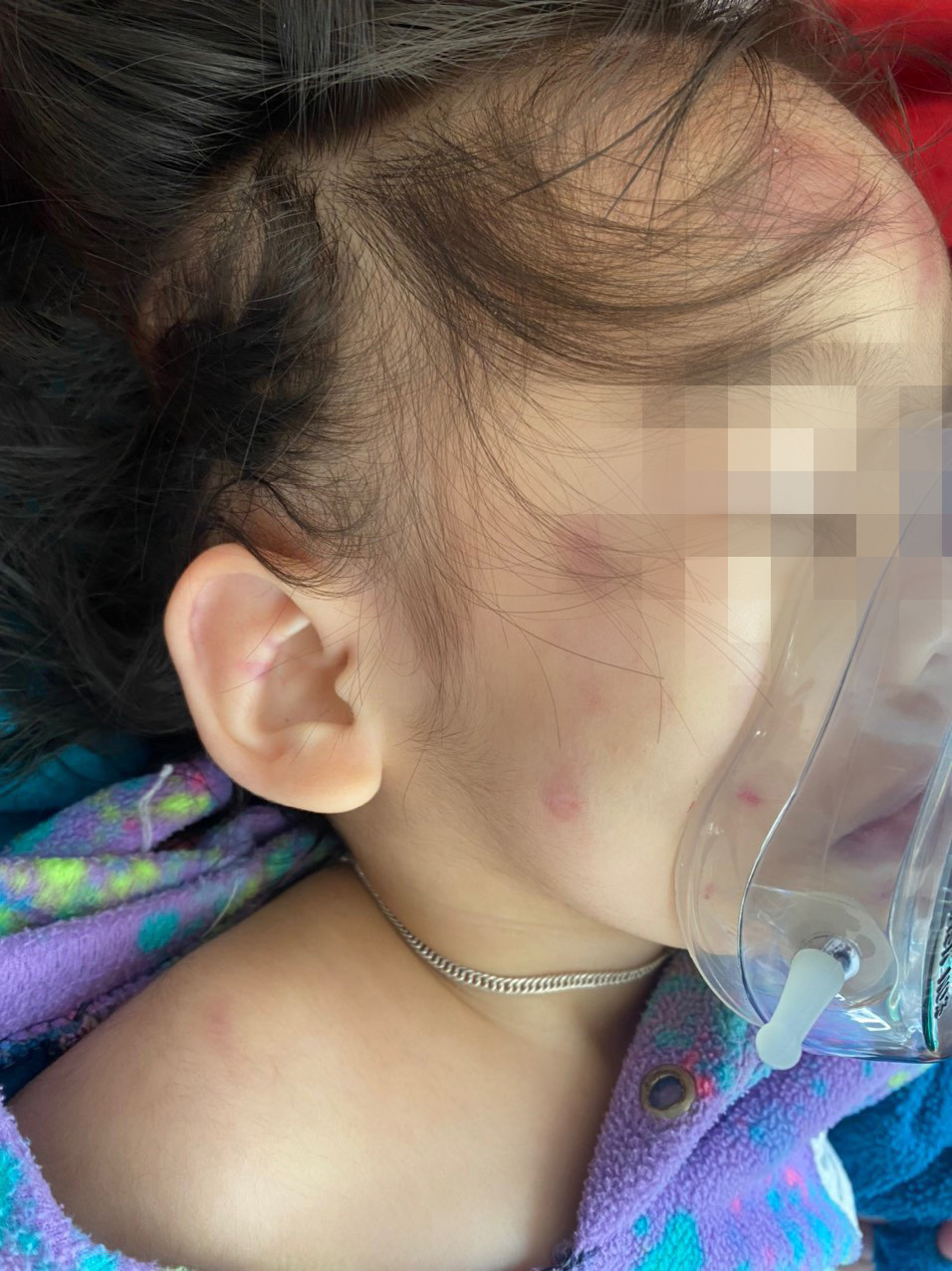 Bé gái 2 tuổi bị 2 bảo mẫu đạp ngã trong nhà tắm, nhiều lần dùng tay đánh - Ảnh 2.
