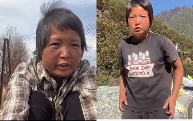 Cô gái 28 tuổi phượt chục nghìn cây số 3 năm khiến gương mặt từ thiếu nữ thành bà thím, bác sĩ chỉ ra nguyên nhân bất ngờ - Ảnh 2.