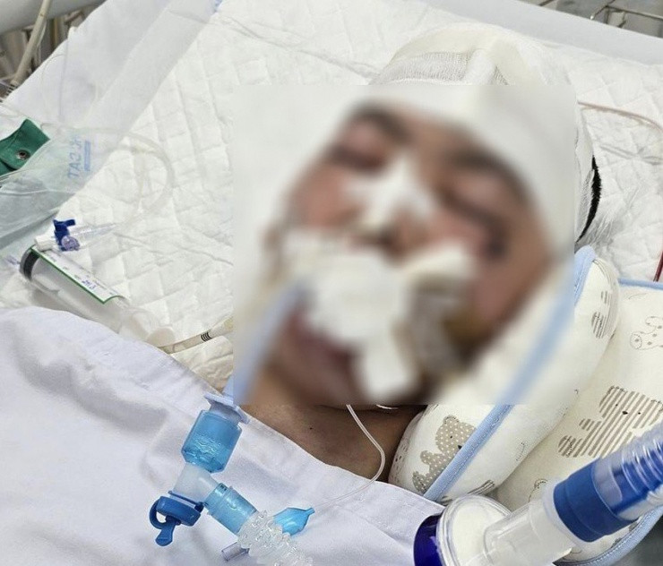 Nam sinh lớp 8 bị đánh chết não đang điều trị tại bệnh viện đa khoa tỉnh Phú Thọ. Ảnh PV