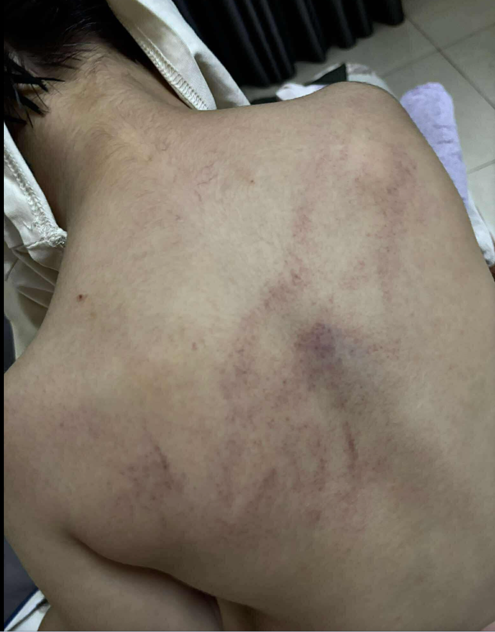 Vụ trẻ nghi bị giáo viên mầm non bạo hành: Công an vào cuộc xác minh - 1