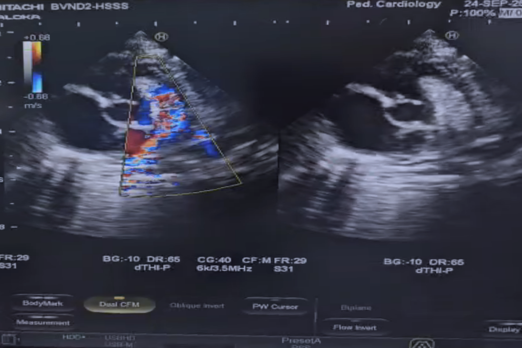 Căn bệnh hiểm ở tim, trẻ mắc phải dễ tử vong trước tuổi trưởng thành - 2