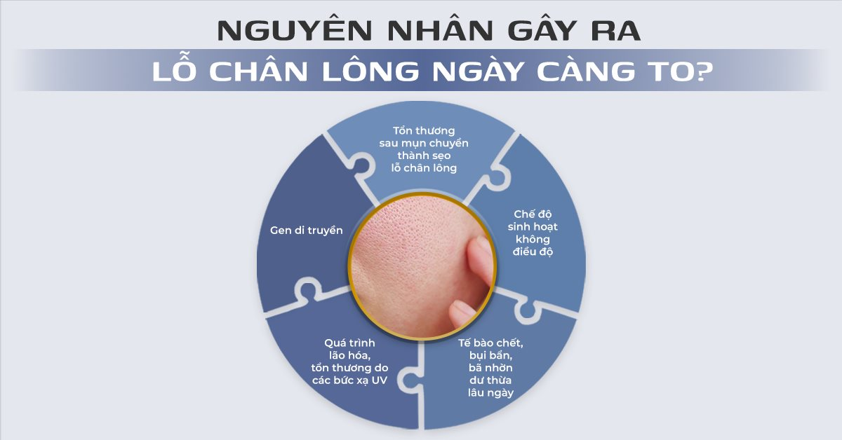 nguyen-nha-ga-ra-lo-chan-long-to.png
