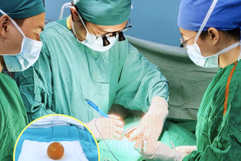 Nhiều trẻ nguy kịch vì thứ dễ nuốt vào miệng: Lời cảnh báo cha mẹ dịp Tết - 1