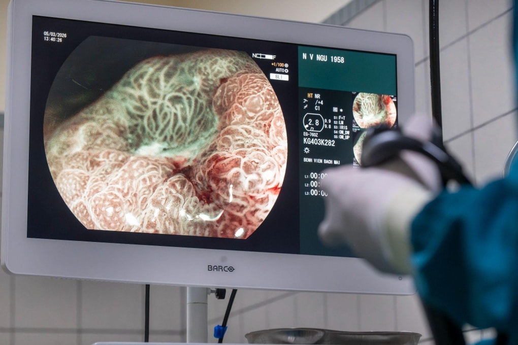 Bác sĩ Bạch Mai cảnh báo cách ăn của nhiều người “tiếp tay” cho ung thư - 2