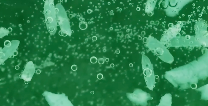 Vi khuẩn Vibrio vulnificus – thường được gọi là vi khuẩn ăn thịt người. Ảnh: Bệnh viện cung cấp