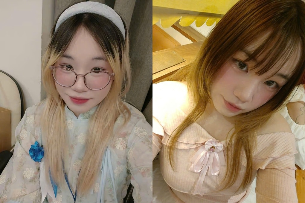 Bị ung thư xương phải cắt cụt chi năm 15 tuổi, nữ sinh vì mẹ mà tái sinh - 4