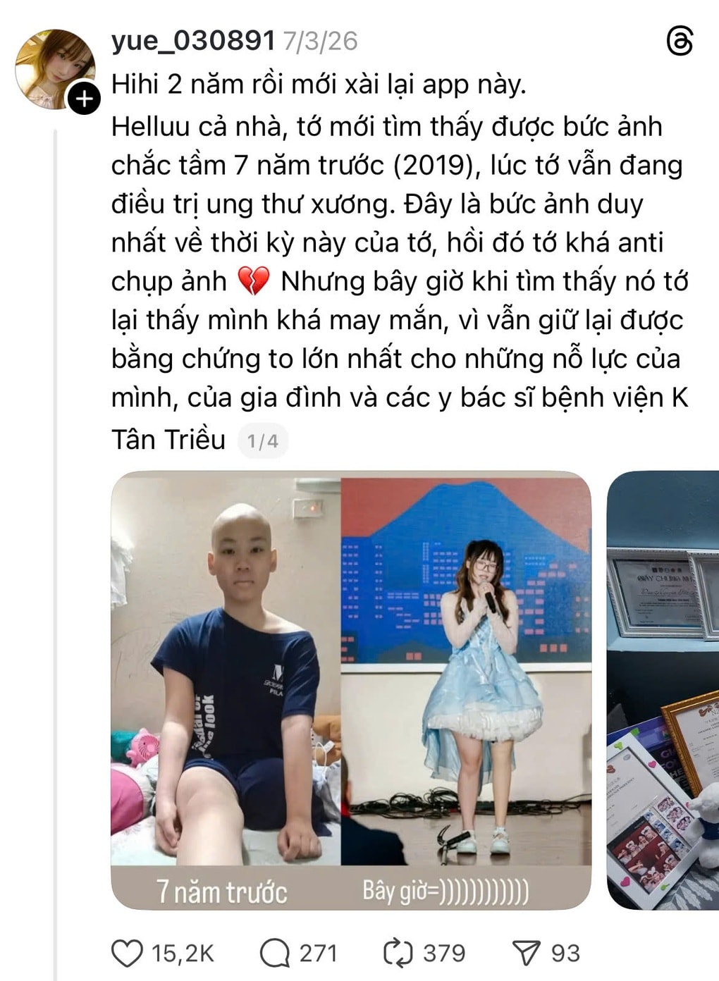 Bị ung thư xương phải cắt cụt chi năm 15 tuổi, nữ sinh vì mẹ mà tái sinh - 1