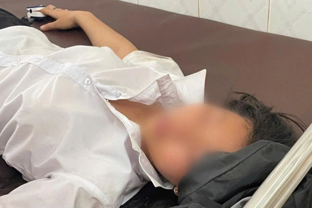 Nữ sinh lớp 7 nhập viện sau khi bị bạn cùng trường đánh tới tấp - 2