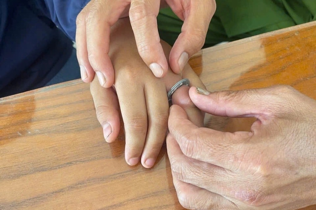 Đưa học sinh bị kẹt ngón tay trong vòng sắt đến cảnh sát nhờ hỗ trợ - 1