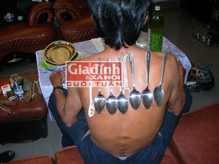 Chuyện khó tin về người đàn ông Việt tự phóng điện Chuyện khó tin về người đàn ông Việt tự phóng điện