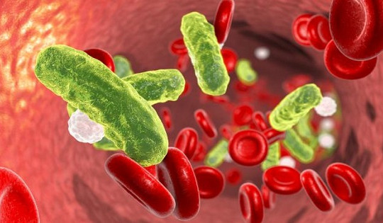 Nhiễm khuẩn huyết do salmonella ở bệnh nhân AIDS