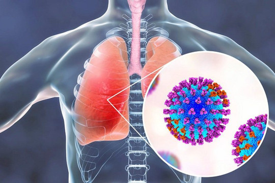 Nguy cơ viêm phổi do phế cầu khuẩn ở người cao tuổi