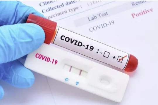 Bộ Y tế quy định mới giá xét nghiệm Covid-19 giảm 30%