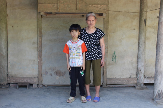 Tuyên Quang: Chàng trai 17 tuổi mang hình hài cậu bé lên 5
