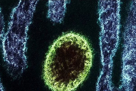 Trung Quốc phát hiện virus mới, triệu chứng giống Covid-19