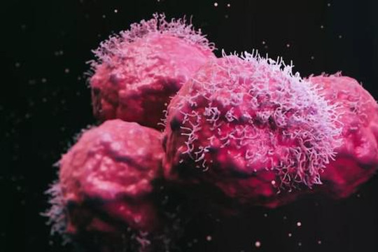 Người phụ nữ được chẩn đoán mắc 12 khối u có đột biến gien chưa từng thấy ở người