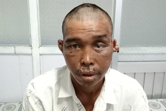 Thuyền viên bị bạo hành: 'Họ bắt tôi ăn 11 con cá sống'