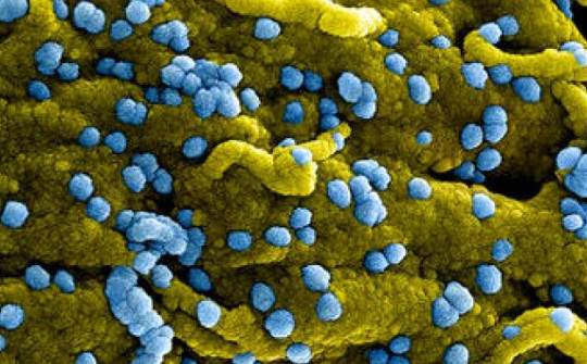 Bác sĩ BV Bạch Mai thông tin về virus Marburg cực nguy hiểm