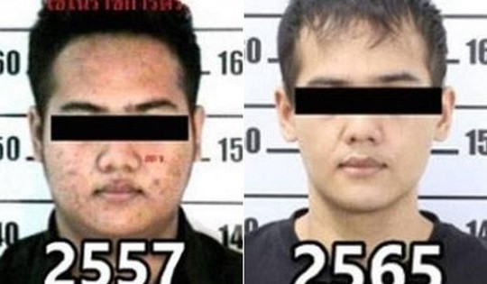 Bắt trùm ma túy Thái Lan dù đã phẫu thuật thẩm mỹ thay nhân dạng
