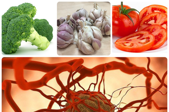 18 thực phẩm hỗ trợ phòng chống ung thư nên biết