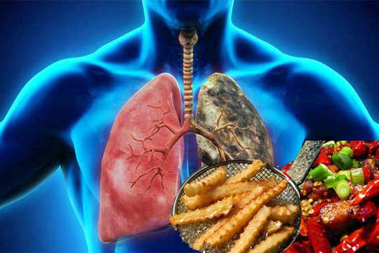 Những thực phẩm gây hại cho phổi mà nhiều người vẫn ăn hàng ngày