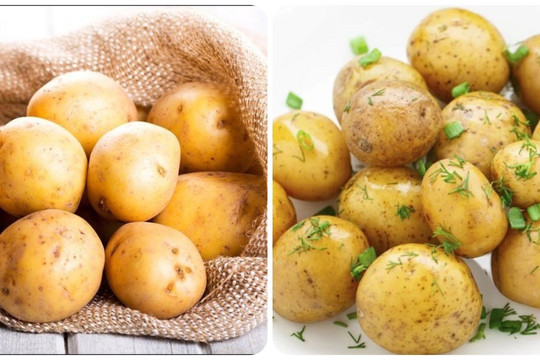 5 tác hại của khoai tây với sức khỏe nếu bạn ăn quá nhiều