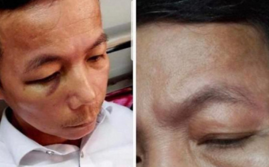 Vụ hiệu trưởng đánh hiệu phó nhập viện ở Quảng Bình: Cả hai cùng bị phạt tiền