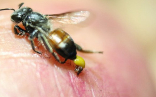 Cách sơ cứu khi bị ong đốt: Những điều ai cũng phải biết