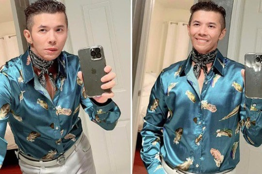 Kasim Hoàng Vũ lên tiếng khi xuất hiện với gương mặt lạ