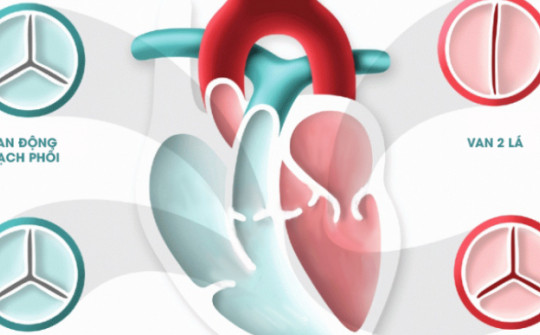 Hở van tim gây biến chứng suy tim: Hướng dẫn cách phòng ngừa hiệu quả