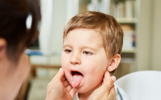 Đẩy lùi viêm mũi họng cấp ở trẻ tưởng khó hóa dễ nhờ cách này