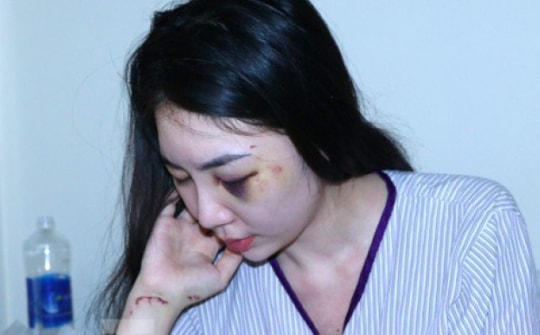 Hé lộ nguyên nhân người đàn ông cầm ghế đánh tới tấp vào đầu cô gái