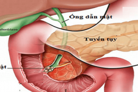 5 loại thực phẩm "giết chết" tuyến tụy