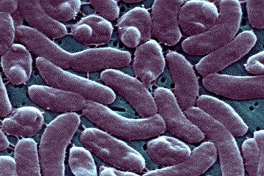 CDC Mỹ cảnh báo sức khỏe sau khi 5 người chết vì 'vi khuẩn ăn thịt người'