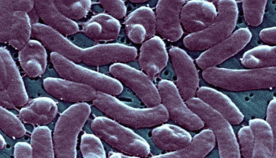 CDC Mỹ cảnh báo sức khỏe sau khi 5 người chết vì "vi khuẩn ăn thịt người"