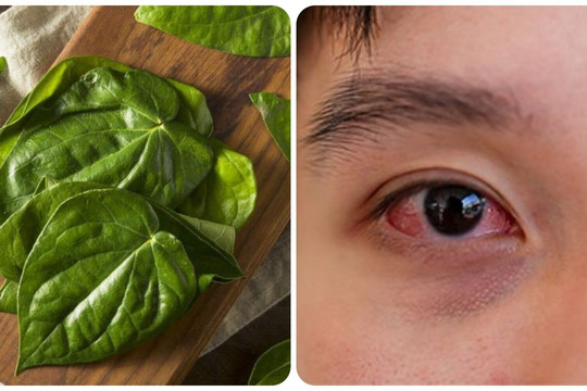 Chữa đau mắt đỏ bằng lá trầu không có thực sự hiệu quả?