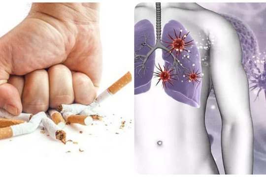 Điều gì xảy ra với cơ thể khi bạn bỏ thuốc lá?