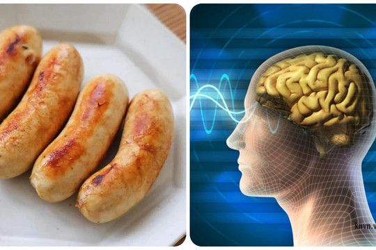 5 loại thực phẩm có hại cho não nhưng nhiều người vẫn hồn nhiên ăn
