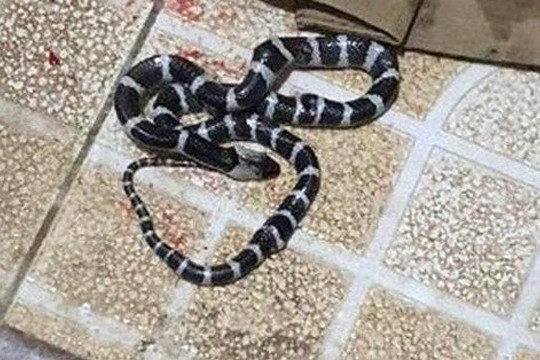 Bé 10 tuổi được cứu sống kỳ diệu khi bị rắn cực độc cắn