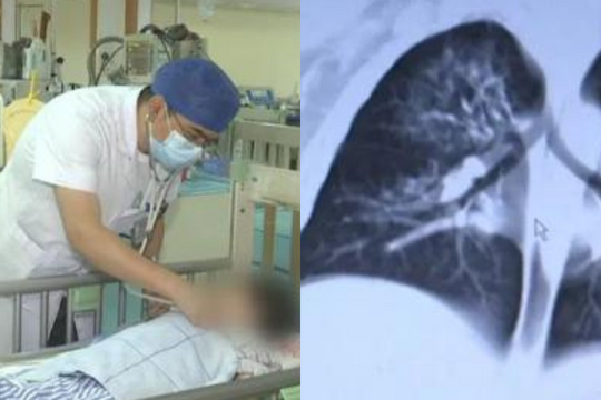Bé trai 2 tuổi chứa hơn 10 loại vi khuẩn trong phổi, bác sĩ chỉ ra 3 "ổ mầm bệnh" nhà nào cũng có