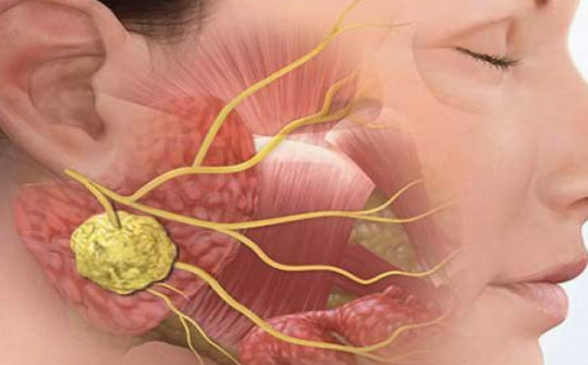 Ung thư vòm họng và những dấu hiệu nhận biết sớm 