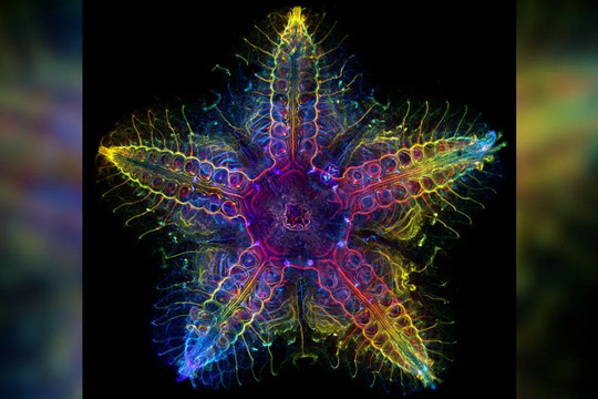 Cấu trúc cơ thể độc đáo của sao biển
