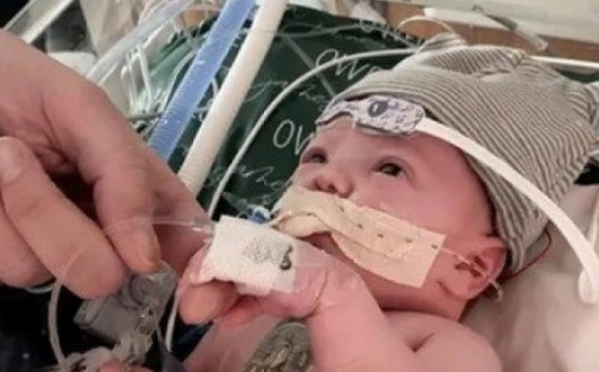 Thông tin mới nhất về em bé được ghép tim đầu tiên trên thế giới