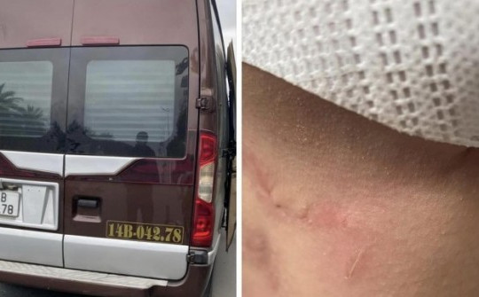Thiếu tướng Đinh Văn Nơi: Xác minh vụ nhà xe bị tố hành hung, bỏ rơi khách giữa cao tốc