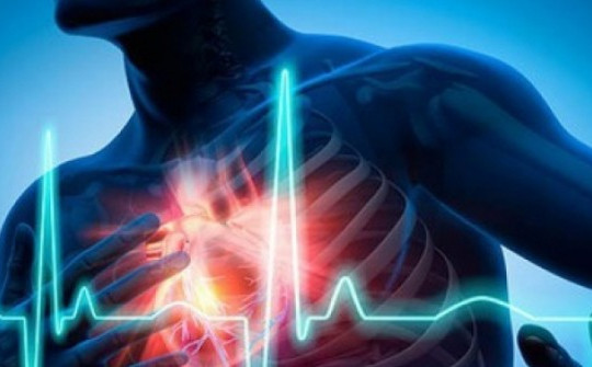 Phương pháp mới: Biết trước cơn nhồi máu cơ tim tận 6 tháng