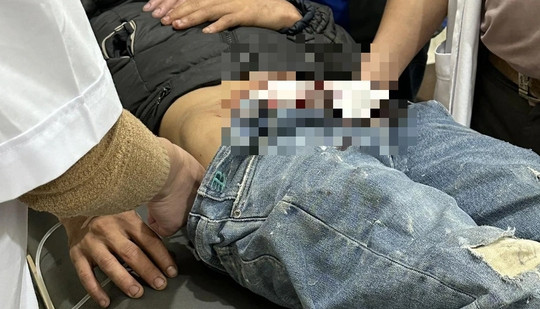 Nam thanh niên ở Quảng Bình nghi tự lấy kéo cắt "chỗ hiểm" đứt gãy