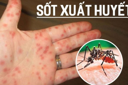 Số người mắc sốt xuất huyết tại Hà Nội đang tăng mạnh