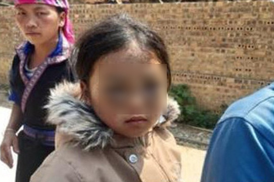 Đình chỉ công tác cô giáo ở Yên Bái bị tố đánh học sinh bầm mắt