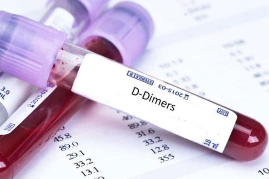 Bộ Y tế chính thức lên tiếng về thông tin "xét nghiệm đông máu sau tiêm vắc xin AstraZeneca"