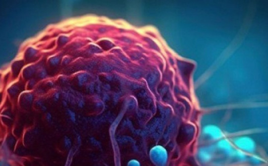 Tìm ra cách mới tiêu diệt loại ung thư phổ biến thứ 2 thế giới